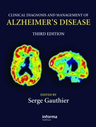 Cover image for Clinical Diagnosis and Management of Alzheimer's Disease