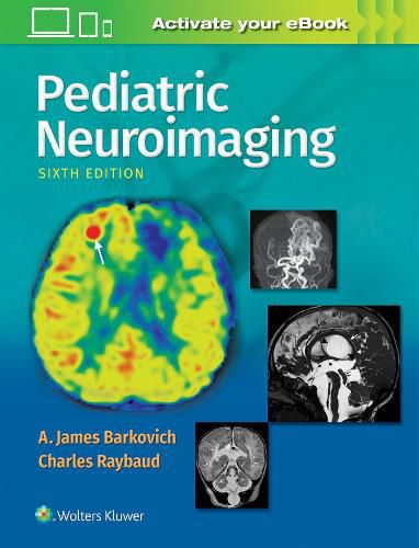 Cover image for Pediatric Neuroimaging