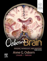 Cover image for Osborn's Brain