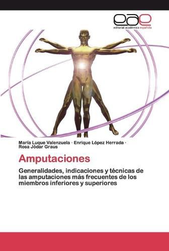 Cover image for Amputaciones