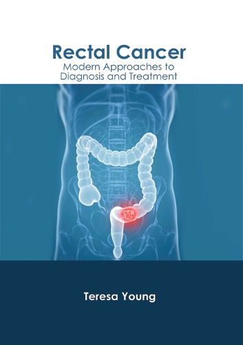 Cover image for Rectal Cancer: Modern Approaches to Diagnosis and Treatment
