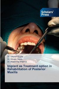 Cover image for Implant as Treatment option in Rehabilitation of Posterior Maxilla