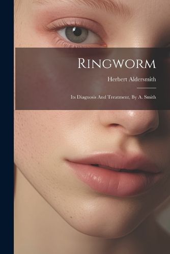 Cover image for Ringworm