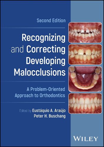 Cover image for Recognizing and Correcting Developing Malocclusions