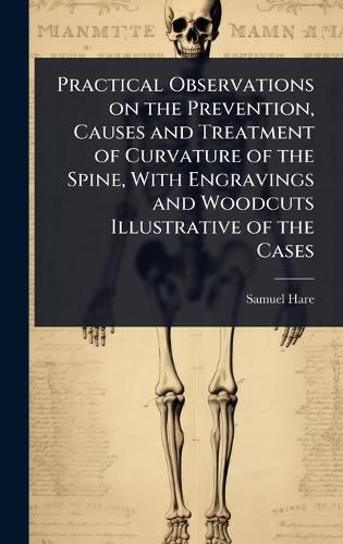 Cover image for Practical Observations on the Prevention, Causes and Treatment of Curvature of the Spine, With Engravings and Woodcuts Illustrative of the Cases