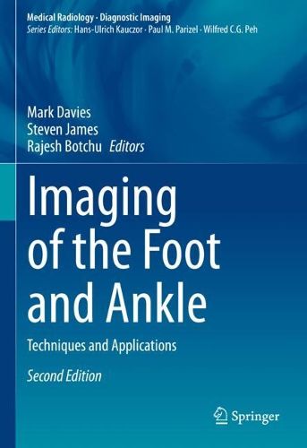 Cover image for Imaging of the Foot and Ankle