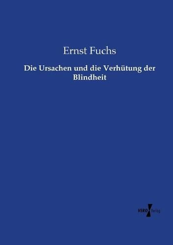 Cover image for Die Ursachen und die Verhutung der Blindheit