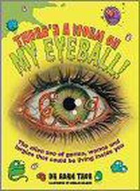 Cover image for There's a Worm on My Eyeball