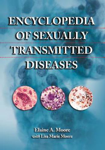 Encyclopedia of Sexually Transmitted Diseases