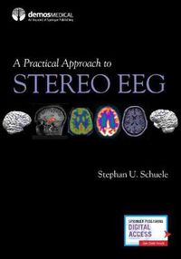 Cover image for A Practical Approach to Stereo EEG