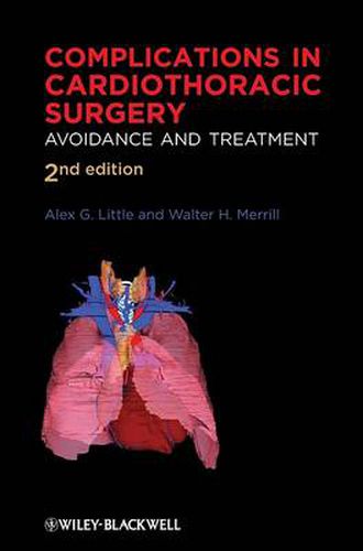 Cover image for Complications in Cardiothoracic Surgery: Avoidance and Treatment