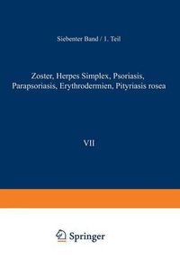 Cover image for Zoster - Herpes Simplex - Psoriasis Parapsoriasis - Erythrodermien Pityriasis Rosea