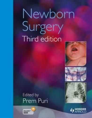 Cover image for Newborn Surgery 3E