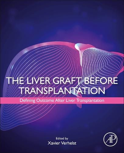 Cover image for The Liver Graft Before Transplantation: Defining Outcome After Liver Transplantation