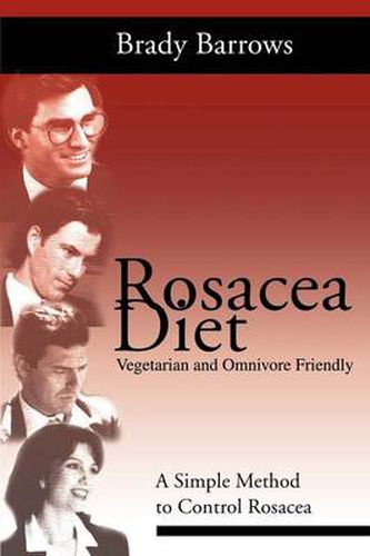 Cover image for Rosacea Diet: A Simple Method to Control Rosacea