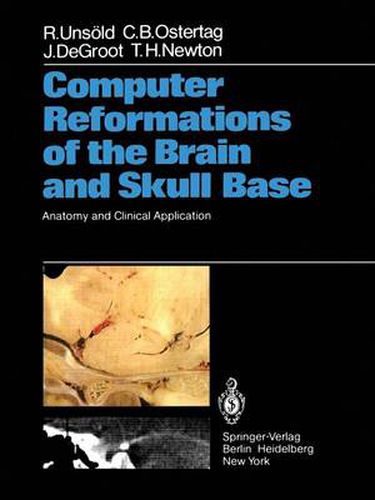 Cover image for Computer Reformations of the Brain and Skull Base: Anatomy and Clinical Application