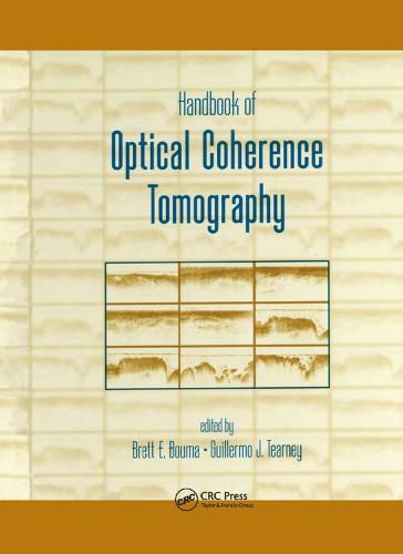 Cover image for Handbook of Optical Coherence Tomography