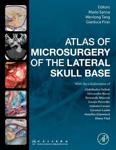 Cover image for Atlas of Microsurgery of the Lateral Skull Base