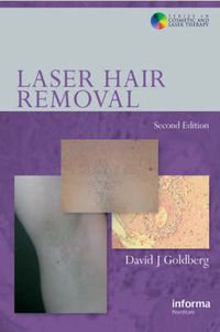 Cover image for Laser Hair Removal