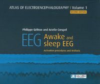 Cover image for Atlas of Electroencephalography: Awake and sleep EEG