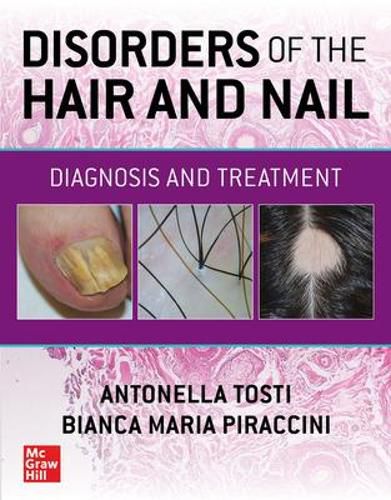 Cover image for Disorders of the Hair and Nail: Diagnosis and Treatment