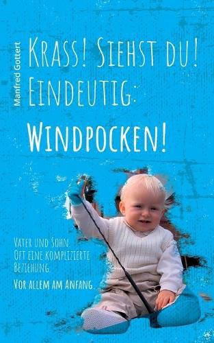 Cover image for Krass! Siehst du! Eindeutig: Windpocken!: Vater und Sohn. Oft eine komplizierte Beziehung. Vor allem am Anfang.