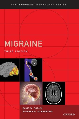 Cover image for Migraine