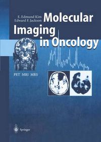 Cover image for Molecular Imaging in Oncology: PET, MRI, and MRS