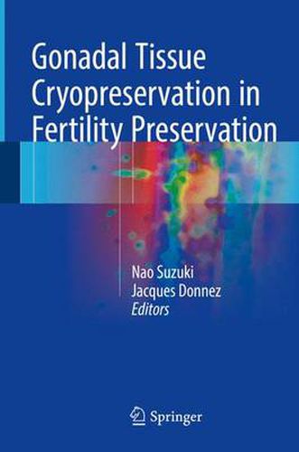 Cover image for Gonadal Tissue Cryopreservation in Fertility Preservation