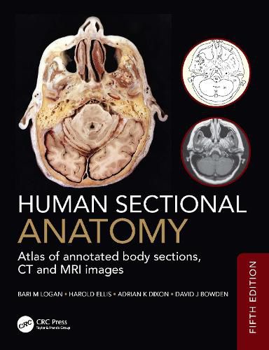 Cover image for Human Sectional Anatomy