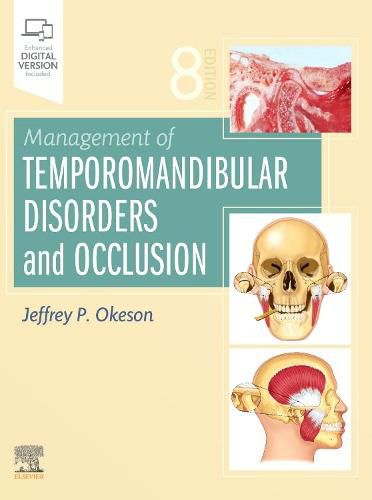 Cover image for Management of Temporomandibular Disorders and Occlusion