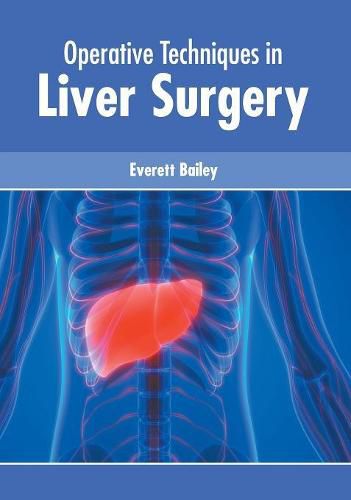 Cover image for Operative Techniques in Liver Surgery