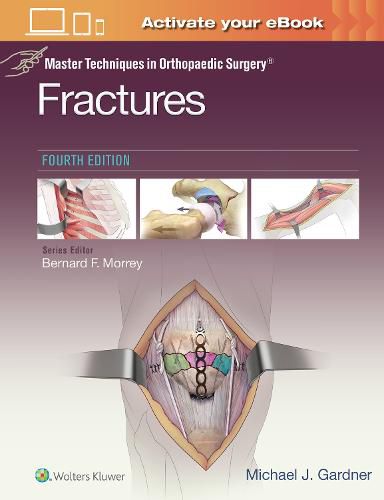 Cover image for Master Techniques in Orthopaedic Surgery: Fractures