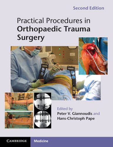 Cover image for Practical Procedures in Orthopaedic Trauma Surgery