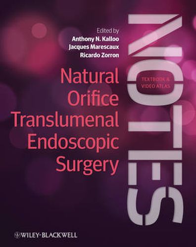 Cover image for Natural Orifice Translumenal Endoscopic Surgery: Textbook and Video Atlas