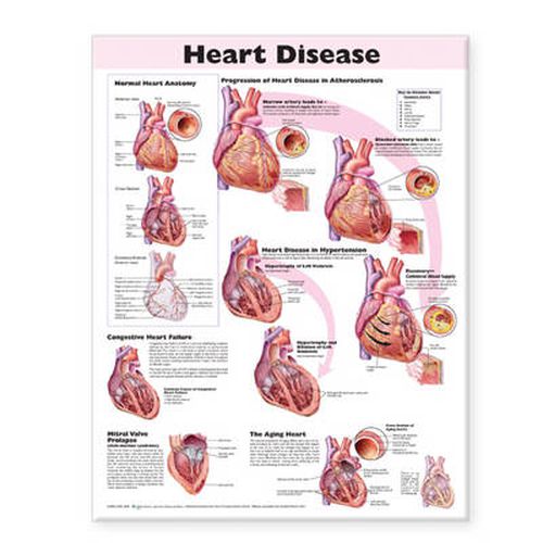 Cover image for Heart Disease Anatomical Chart