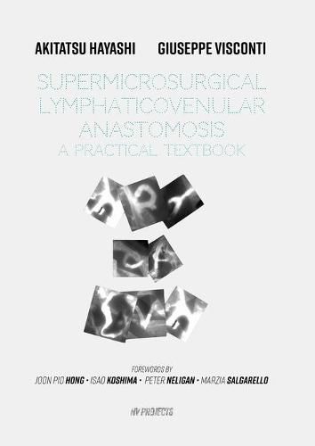 Cover image for Supermicrosurgical LymphaticoVenular Anastomosis