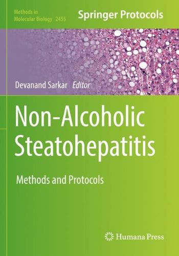 Cover image for Non-Alcoholic Steatohepatitis