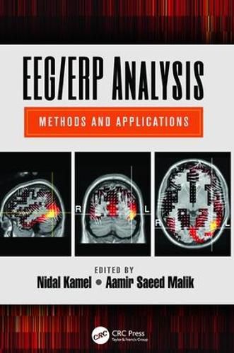 Cover image for EEG/ERP Analysis: Methods and Applications