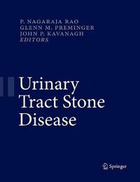 Cover image for Urinary Tract Stone Disease