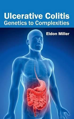 Cover image for Ulcerative Colitis: Genetics to Complexities