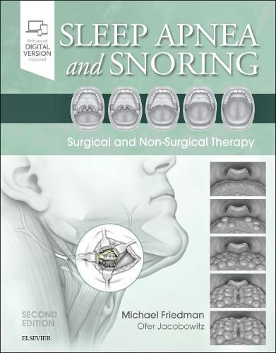 Cover image for Sleep Apnea and Snoring: Surgical and Non-Surgical Therapy