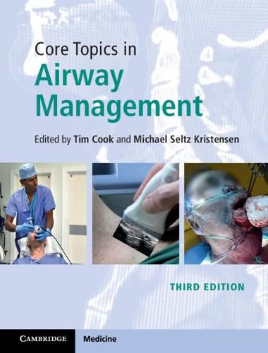 Cover image for Core Topics in Airway Management