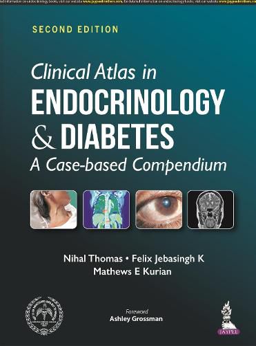 Clinical Atlas in Endocrinology and Diabetes: A Case-based Compendium