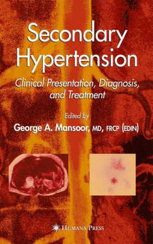 Cover image for Secondary Hypertension: Clinical Presentation, Diagnosis, and Treatment