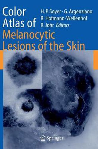 Cover image for Color Atlas of Melanocytic Lesions of the Skin