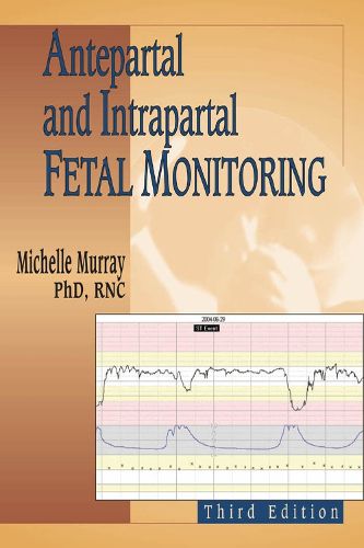 Cover image for Antepartal and Intrapartal Fetal Monitoring