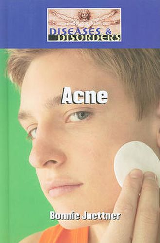 Cover image for Acne