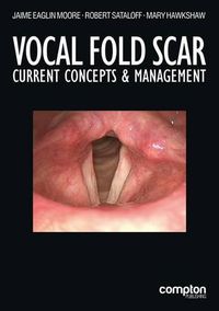 Cover image for Vocal Fold Scar: Current Concepts and Management