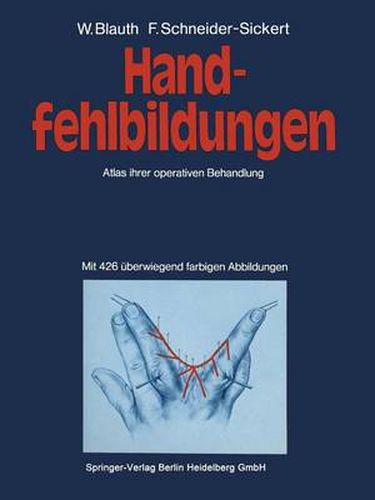 Cover image for Handfehlbildungen: Atlas ihrer operativen Behandlung